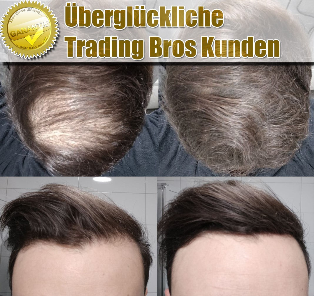 Volles Haar in Sekunden! XXL Premium Streuhaar 28g Haarverdichtung - vegan & nachhaltig